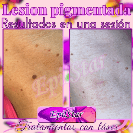 ✨ Resultados en una sesión ✨